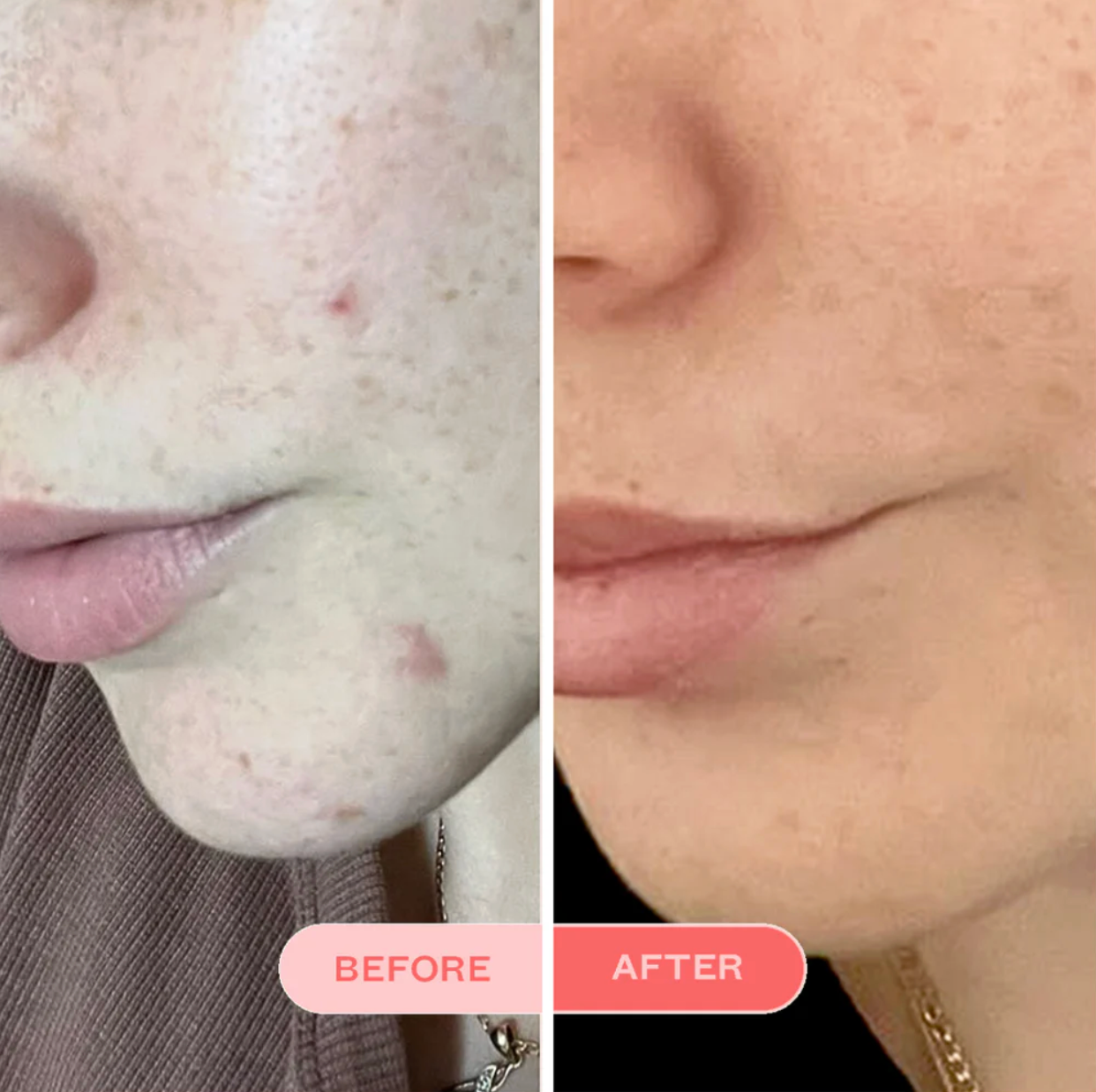 Frank Body Clearing Face Wash